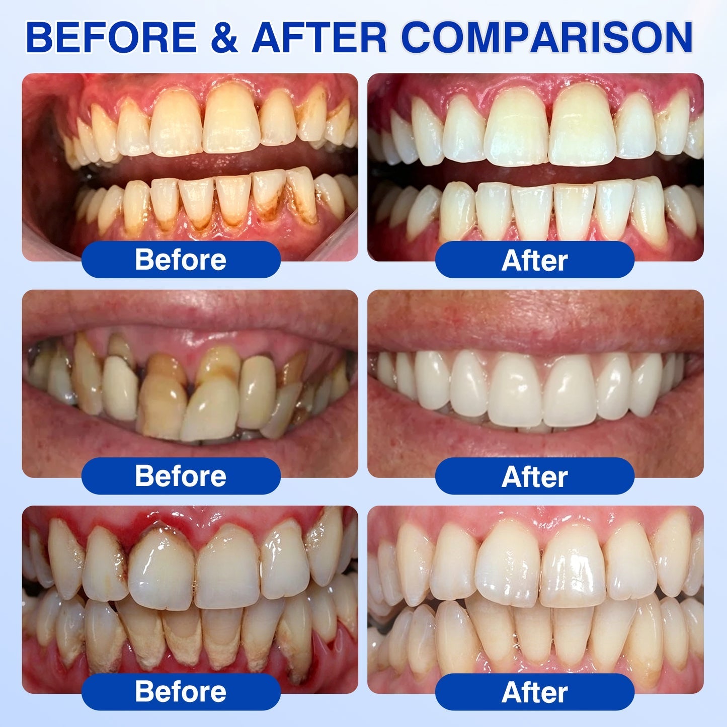 🇬🇧🏅🦷🛡️𝐍𝐚𝐭𝐫𝐚𝐯𝐨𝐫® GumRevive Gum & Periodontal Care Gel
