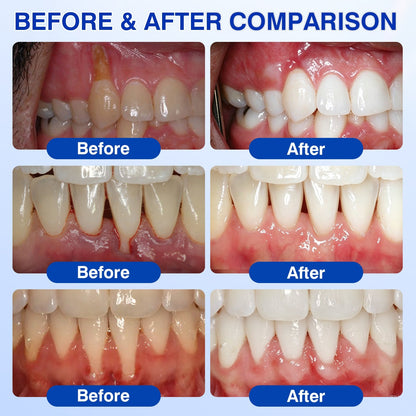 🇬🇧🏅🦷🛡️𝐍𝐚𝐭𝐫𝐚𝐯𝐨𝐫® GumRevive Gum & Periodontal Care Gel