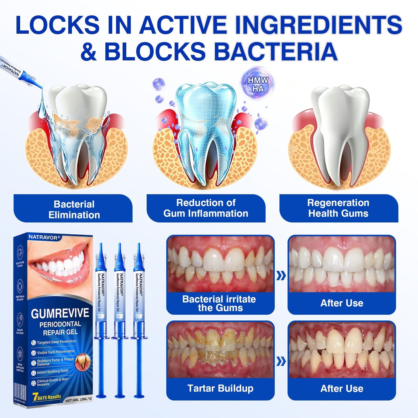 🇬🇧🏅🦷🛡️𝐍𝐚𝐭𝐫𝐚𝐯𝐨𝐫® GumRevive Gum & Periodontal Care Gel