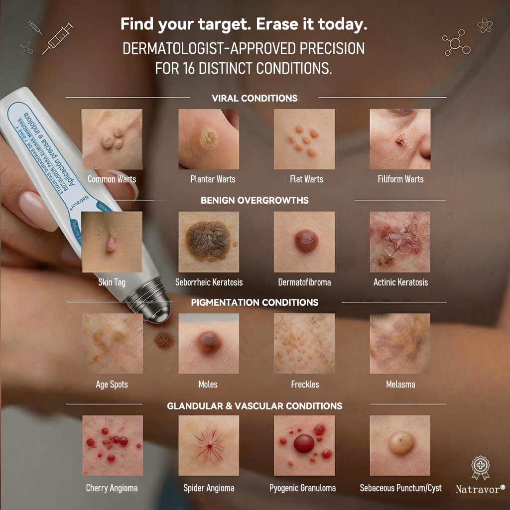 Official Brand Store |✅🧑🏻‍⚕️Natravor® 7-Day Tag & Spot Eraser(Zero Pain, Zero Scars Rollerball)