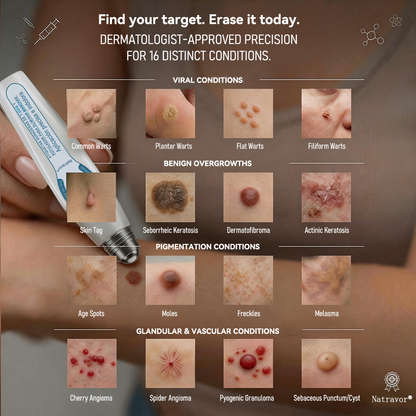 Official Brand Store |✅🧑🏻‍⚕️Natravor® 7-Day Tag & Spot Eraser(Zero Pain, Zero Scars Rollerball)